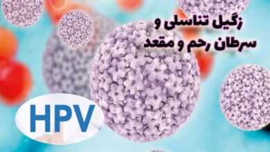زگیل تناسلی و اچ پی وی HPV