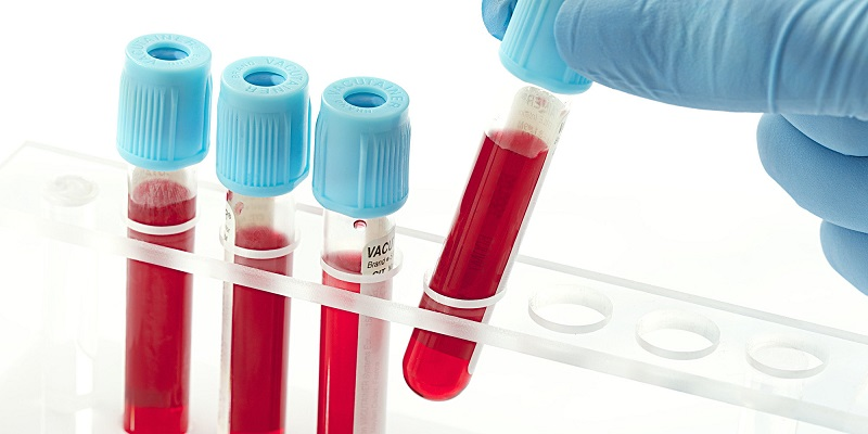 انواع آزمایش خون