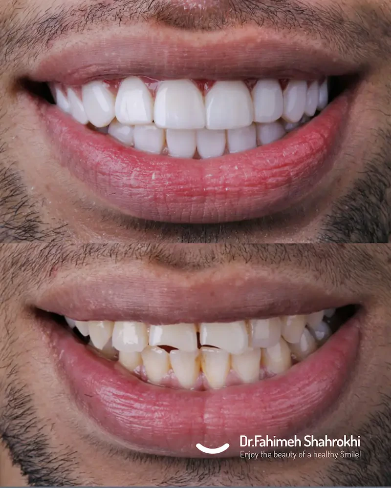 معرفی 7 دندانپزشک خوب در مشهد