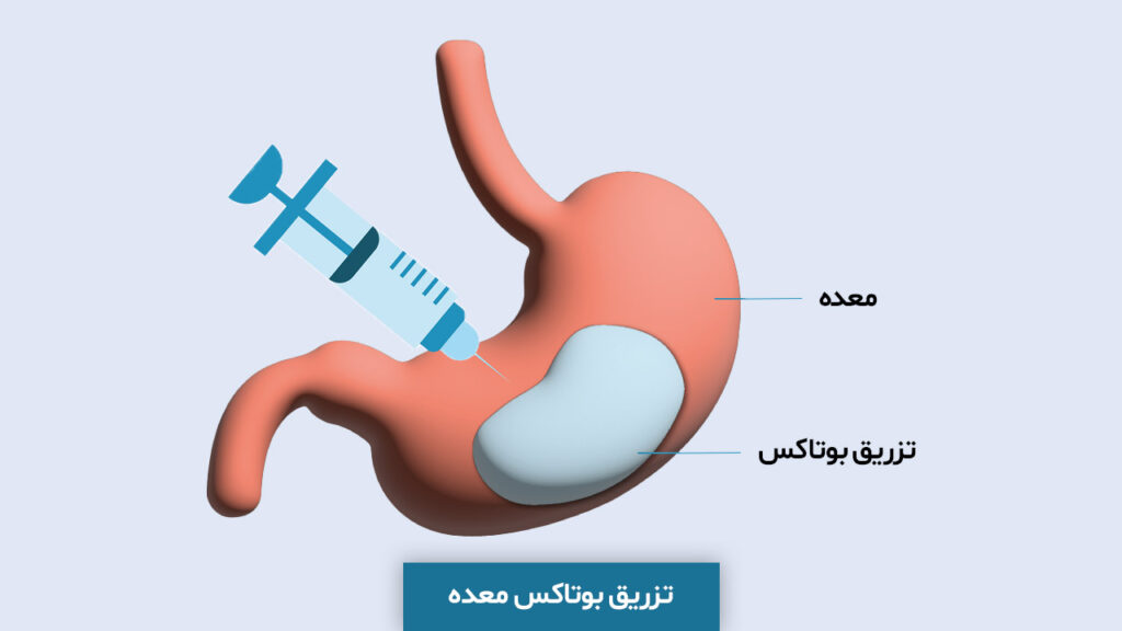 محاسبه bmi چگونه است